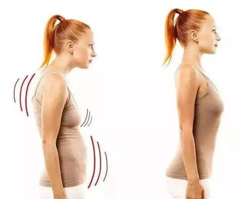 治疗成人驼背视频讲解,视频教程详解